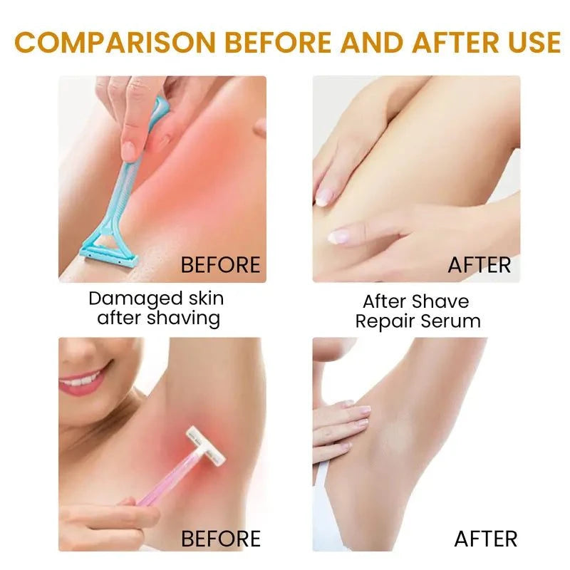 Bikini Area Soothing Serum | Smooth Skin Body Care